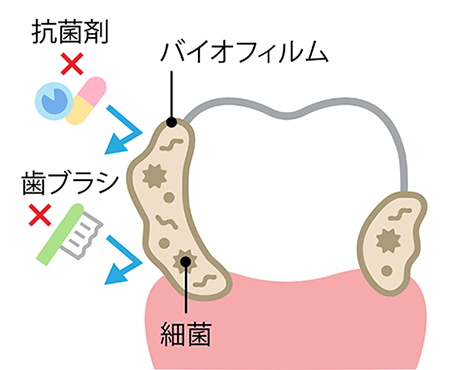 バイオフィルムとは